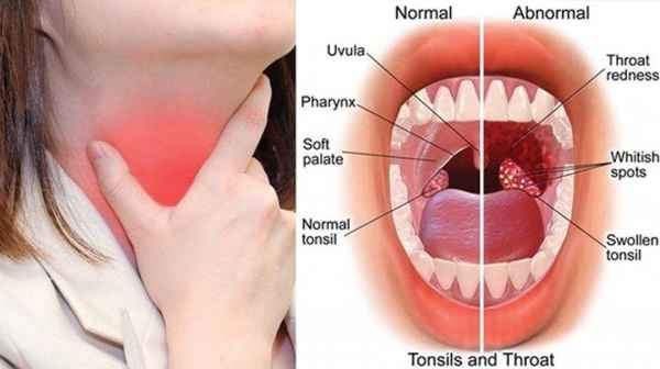 dokter THT penang juga menangani berkaitan kanker THT, mulut, hidung dan telinga